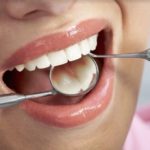 Implanty zębowe to gwarancja zdrowego uśmiechu
