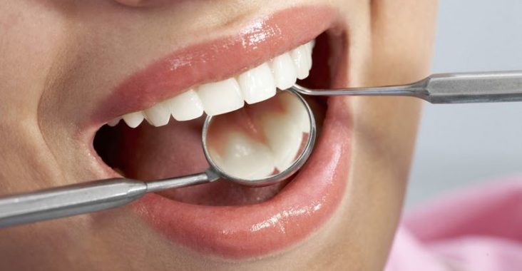 Implanty zębowe to gwarancja zdrowego uśmiechu